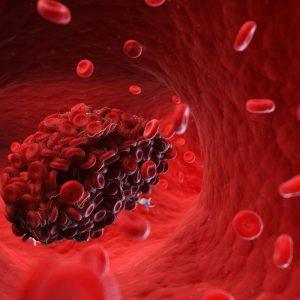 Apie kraujo krešulį, pasak medikų, gali įspėti ir ši kūno dalis. Pasitikrinkite