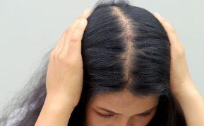 Ekspertai patarė, kokie 6 maisto produktai mažina plaukų slinkimo riziką