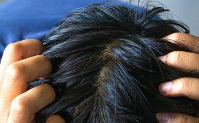 Ką daryti, jei jūsų plaukai kasdien riebaluojasi?