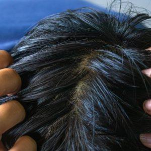 Ką daryti, jei jūsų plaukai kasdien riebaluojasi?