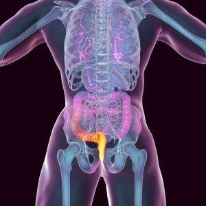 Kada yra reikalinga hemorojaus operacija? Atsako ekspertai