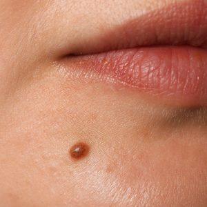 Kaip nuspėti žmogaus likimą pagal apgamus?