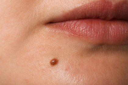 Kaip nuspėti žmogaus likimą pagal apgamus?