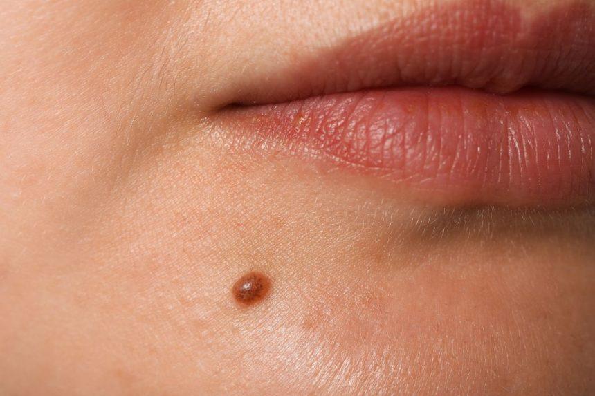 Kaip nuspėti žmogaus likimą pagal apgamus?