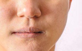 Kuo skiriasi sausa ir jautri oda?