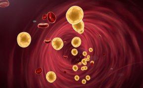 Mokslas paneigė senus mitus apie cholesterolį ir keičia mūsų supratimą apie sveikatą.