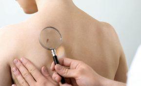 Onkologas pasakoja apie metodą, leidžiantį aptikti nematomus odos darinius