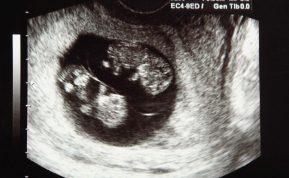 Seniausia mama pasaulyje: 74 metų moteris pagimdė dvynukes