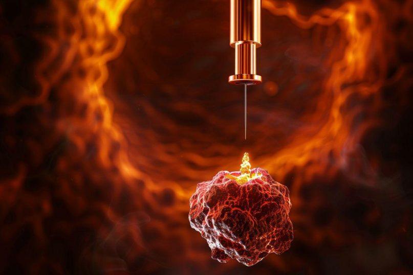 Kodėl Izraelio mokslininkai iš tiesų priartėjo prie vėžio sunaikinimo be chemoterapijos šalutinio poveikio