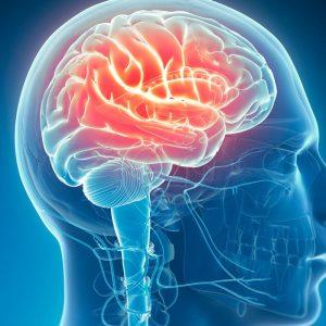 4 aiškūs požymiai, kad asmenį gali ištikti insultas.