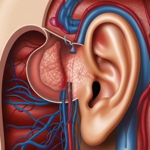 Preaurikuliarinė fistula: kodėl kai kurie žmonės gimsta su skylutėmis ausyse