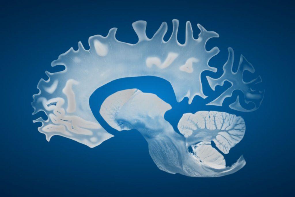 Atspėkite, kurios vynuogės vis dėlto geriausios? 10 priežasčių, kodėl valgyti būtent šias. Prevencija Alzheimeriui