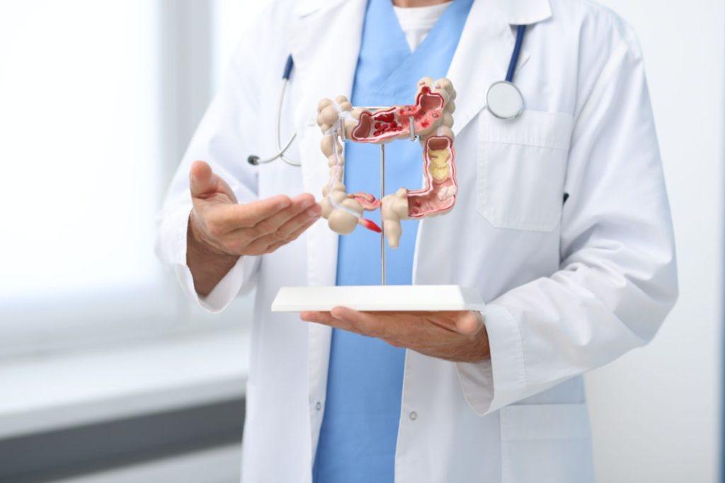 Gastroenterologai atviri: šis sūris – tikras lobis žarnynui, nors daugelis jo vengia. Nauda virškinimo sistemai