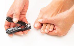 Įaugę nagai yra rimta problema. Šie patarimai padės ją išspręsti namuose