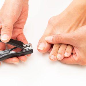 Įaugę nagai yra rimta problema. Šie patarimai padės ją išspręsti namuose