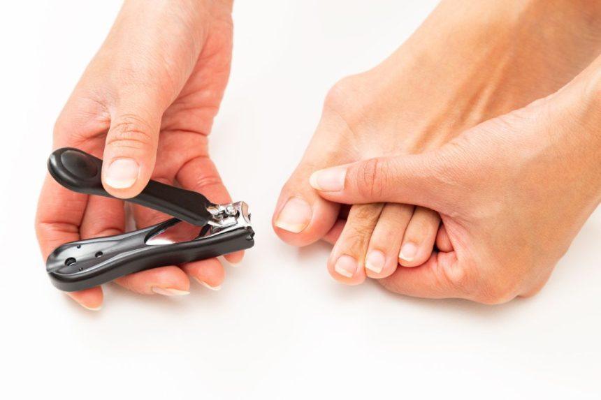 Įaugę nagai yra rimta problema. Šie patarimai padės ją išspręsti namuose