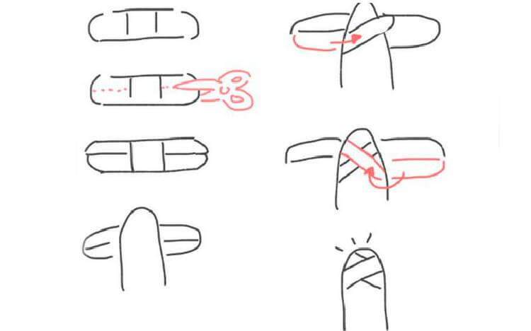 Įkirpkite pleistro kraštus žirklėmis. Daugiau jo kitaip nebenorėsite klijuoti. Kaip paruošti pleistrą klijavimui
