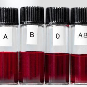 Jei turite pirmąją kraujo grupę, turėtumėte žinoti apie šiuos 5 dalykus.