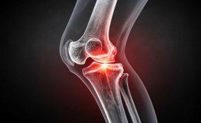 Kaip išsaugoti sveikus sąnarius: specialistų patarimai ir rekomenduojamos fizinės veiklos