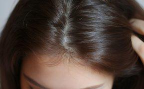 Miegantys plaukų folikulai – mitas ar tiesa? Specialistė paaiškina, kas iš tikrųjų vyksta slenkant plaukams