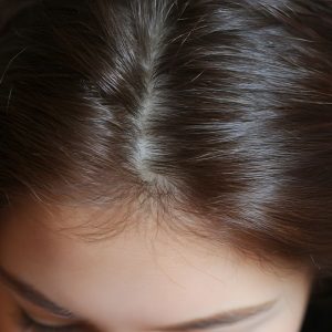 Miegantys plaukų folikulai – mitas ar tiesa? Specialistė paaiškina, kas iš tikrųjų vyksta slenkant plaukams