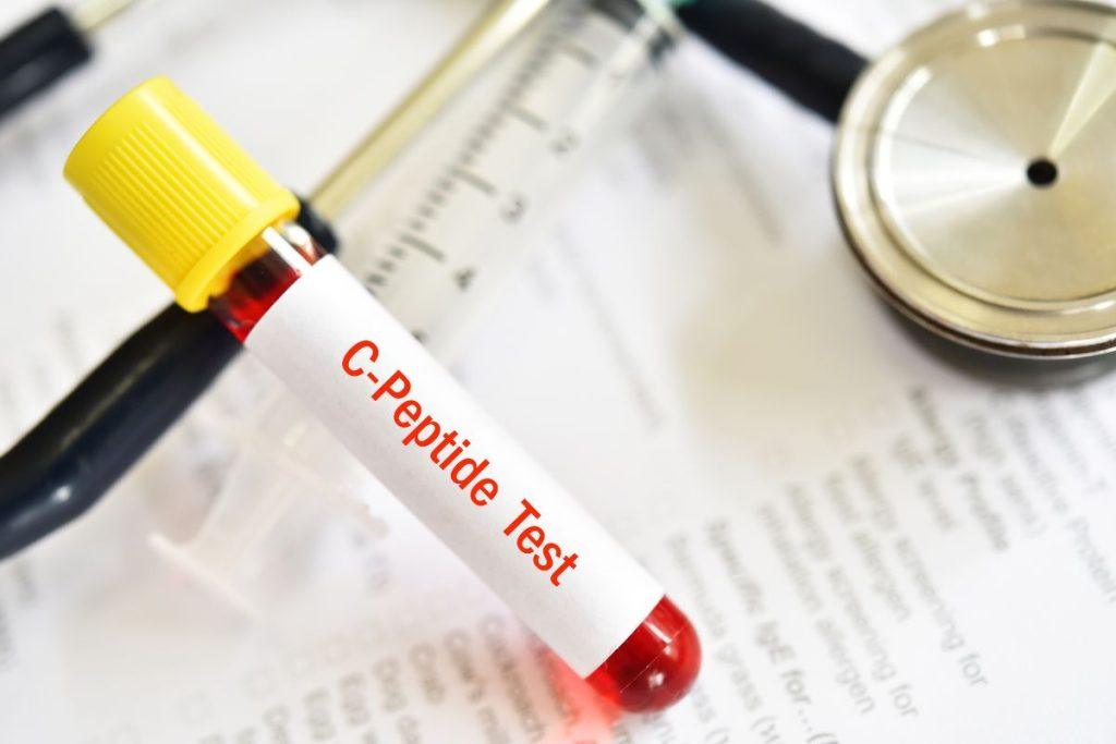 Mokslininkų atradimas, galintis iš tikrųjų pakeisti diabeto diagnozę. C peptidas ne tik atliekos