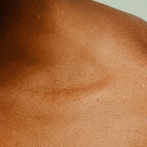 Nekartokite šios klaidos ir jūsų odą nustos niežėti kiekvieną žiemą