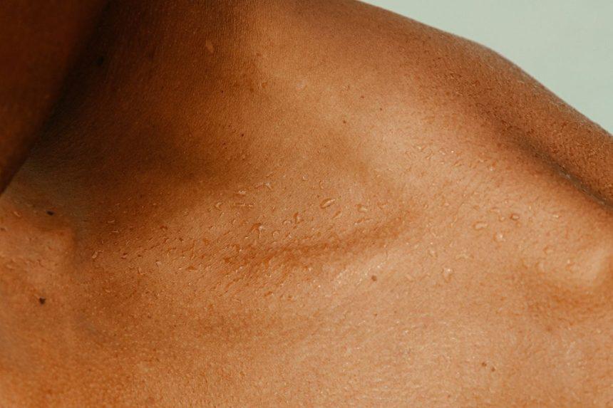 Nekartokite šios klaidos ir jūsų odą nustos niežėti kiekvieną žiemą