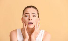 Oda atrodo pavargusi net su brangiais kremais? Šie ženklai rodo, kad trūksta vandens