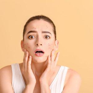 Oda atrodo pavargusi net su brangiais kremais? Šie ženklai rodo, kad trūksta vandens