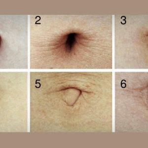 Sužinokite, ką jūsų bambos forma sako apie jus! Išties įdomios įžvalgos