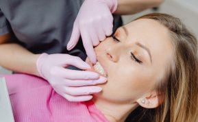 Sužinokite , ką reiškia baltos dėmės ant dantų