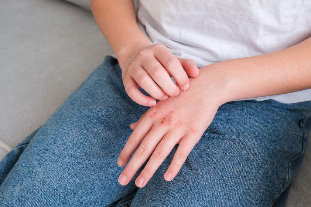 Žiemą rankas išgelbėsiantis triukas, apie kurį grožio industrija nutyli. Kodėl žiemą džiūsta rankos