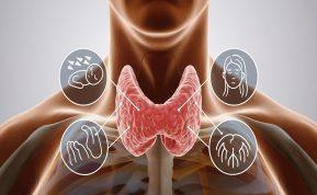 Hipotirozės simptomai: kaip atpažinti skydliaukės hormonų trūkumą