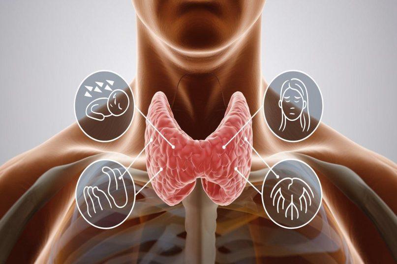 Hipotirozės simptomai: kaip atpažinti skydliaukės hormonų trūkumą