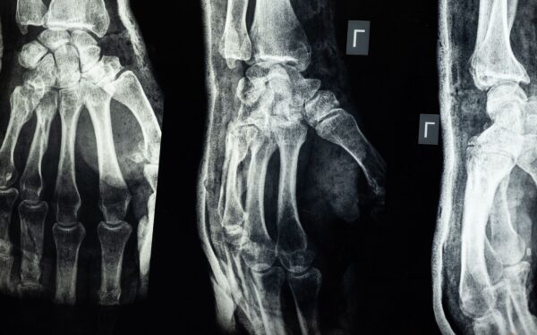 Kaip žmogaus skeletas išlieka tvirtas dešimtmečius: nuo kaulų ląstelių darbo iki osteoporozės prevencijos